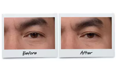 Before and after