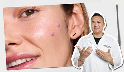 <p>Primer plano de la mejilla de una modelo con puntos de serum rosado que muestran donde aplicar el producto, junto a un especialista con bata blanca senalando el tutorial de aplicacion del cuidado de la piel.</p>