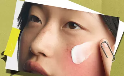 skin-concerns-14