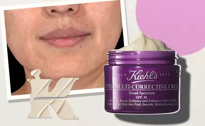 skin-concerns-6
