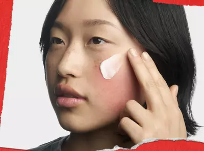 Dermatitis atopica tratamiento 
