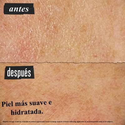 Antes y despues