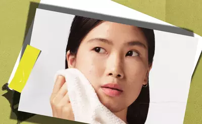 skin-concerns-6