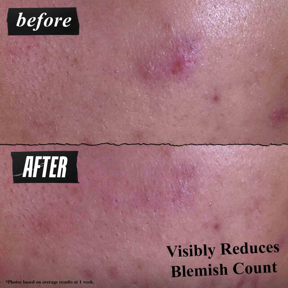 Gently Effective Blemish-Targeting Cleansing Paste