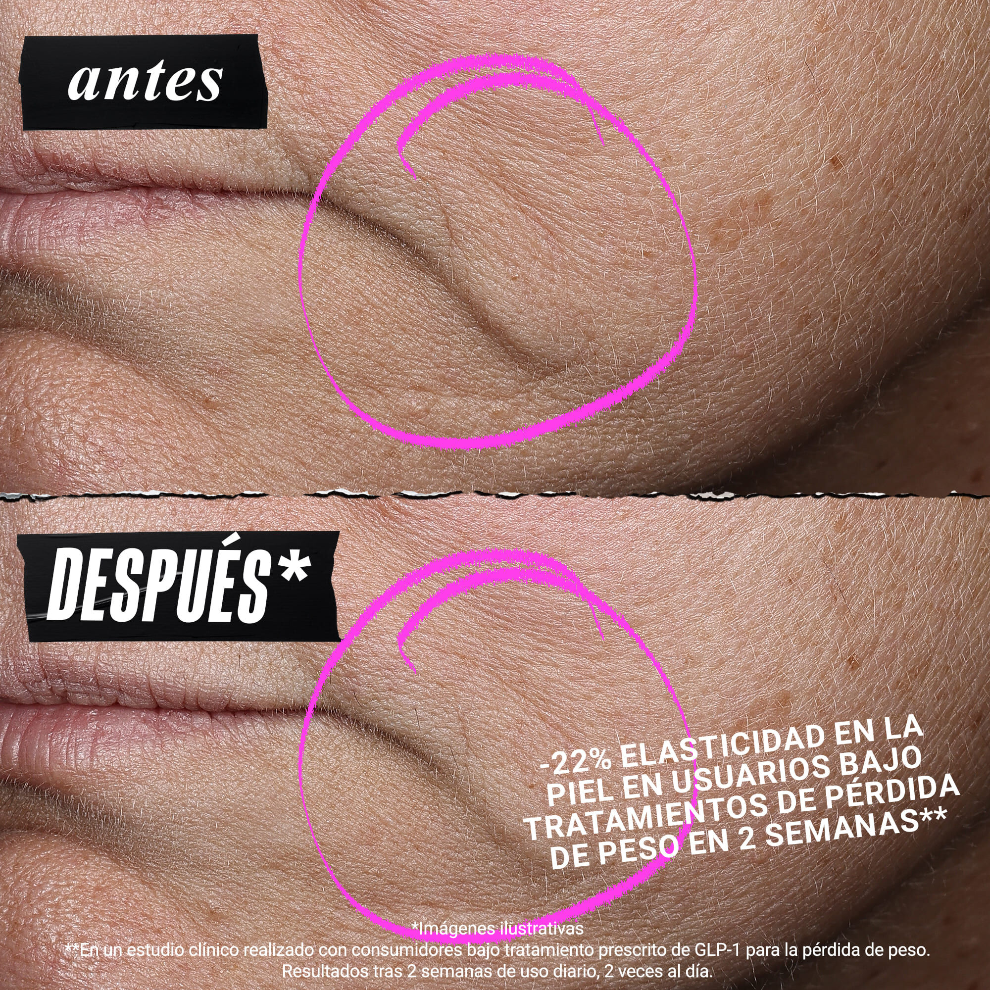 1cc* CollaShot Plump Serum, Serum Facial de Colageno Efecto Lifting y Relleno