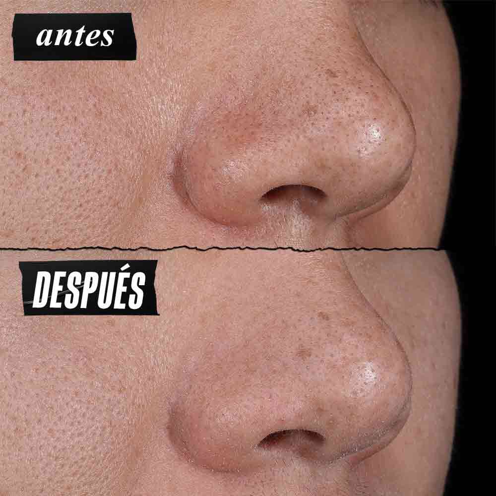 Rare Earth Deep Pore Cleansing Masque